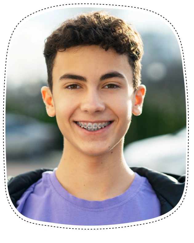 Young boy smiling outdoors wearing purple shirt, displaying healthy teeth