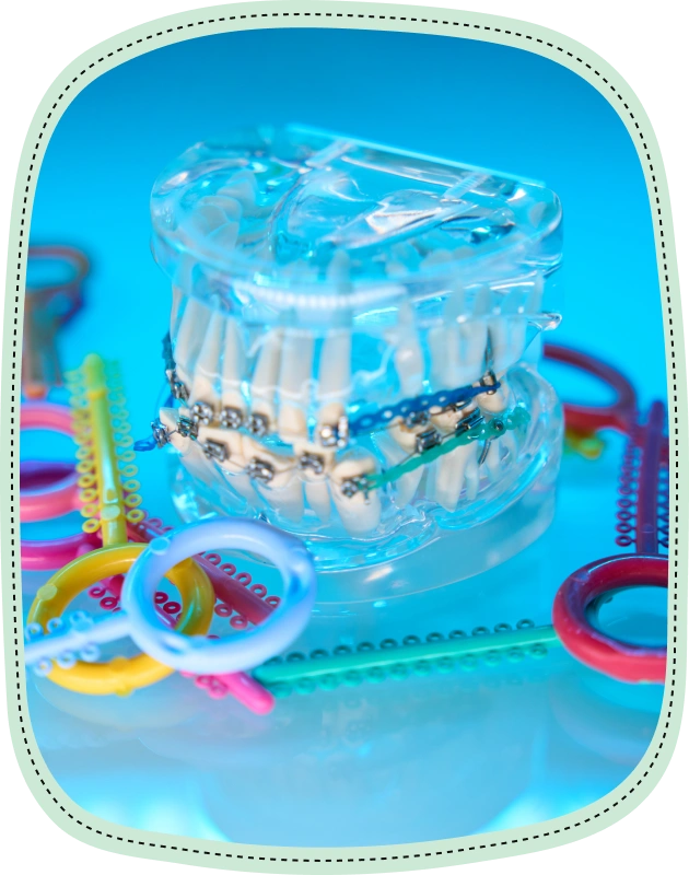 Clear plastic orthodontic braces model surrounded by colorful rubber bands on blue background.