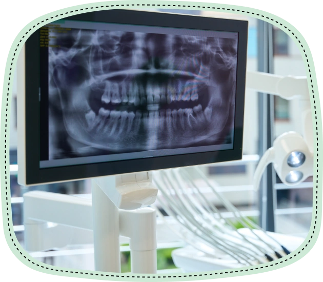Dental X-ray displayed on monitor in pediatric dentistry office with instruments visible.