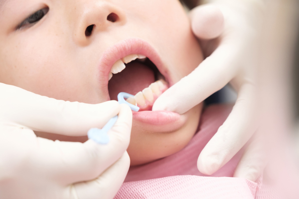 Pediatric Dentist Abilene TX